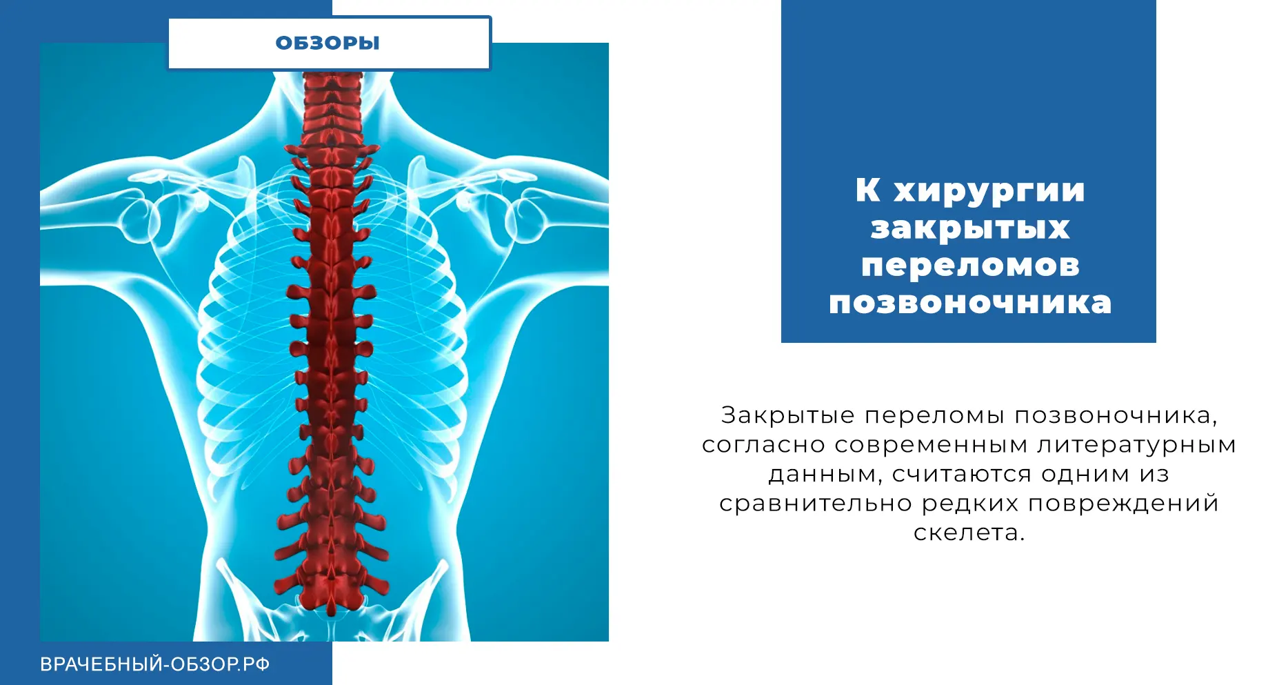 К хирургии закрытых переломов позвоночника