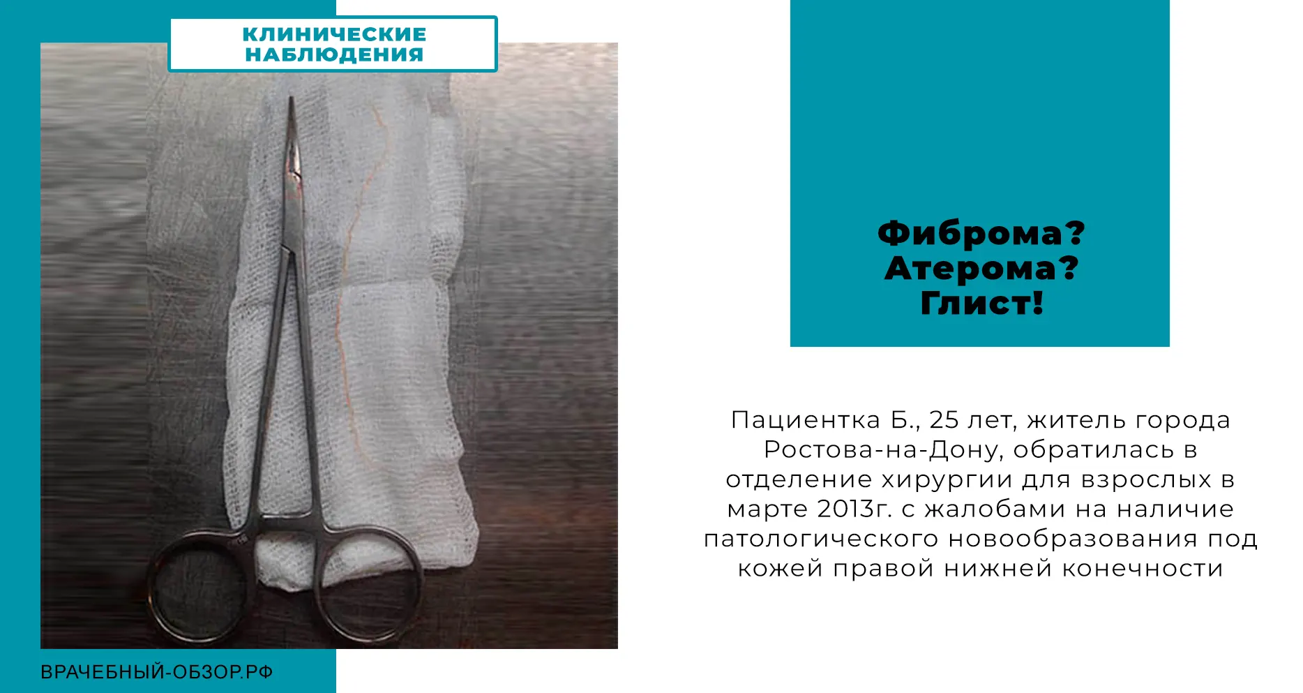 Фиброма? Атерома? Глист!
